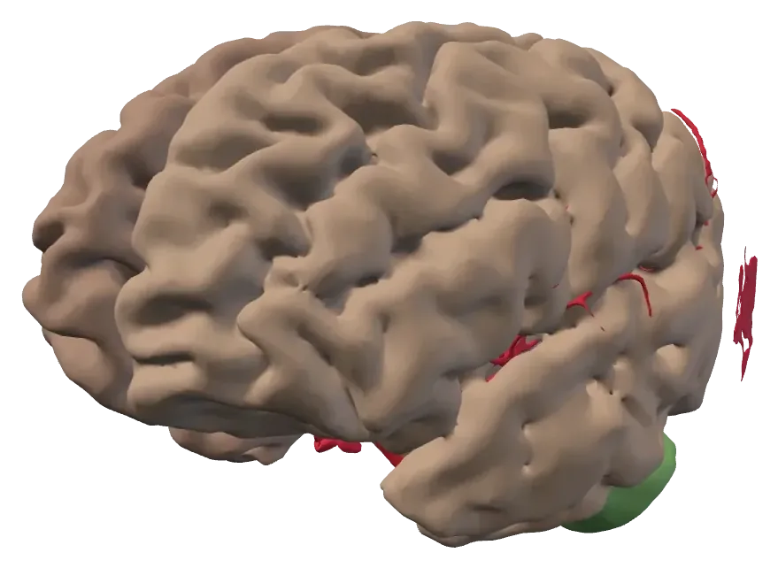 Corteza cerebral reconstruida
